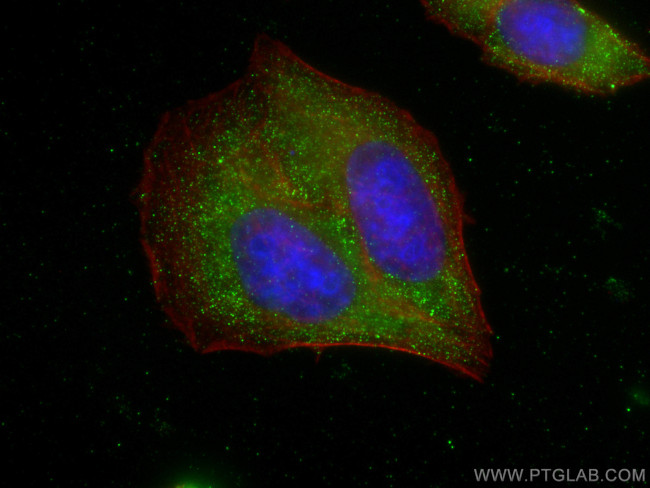 FBXO17 Antibody in Immunocytochemistry (ICC/IF)
