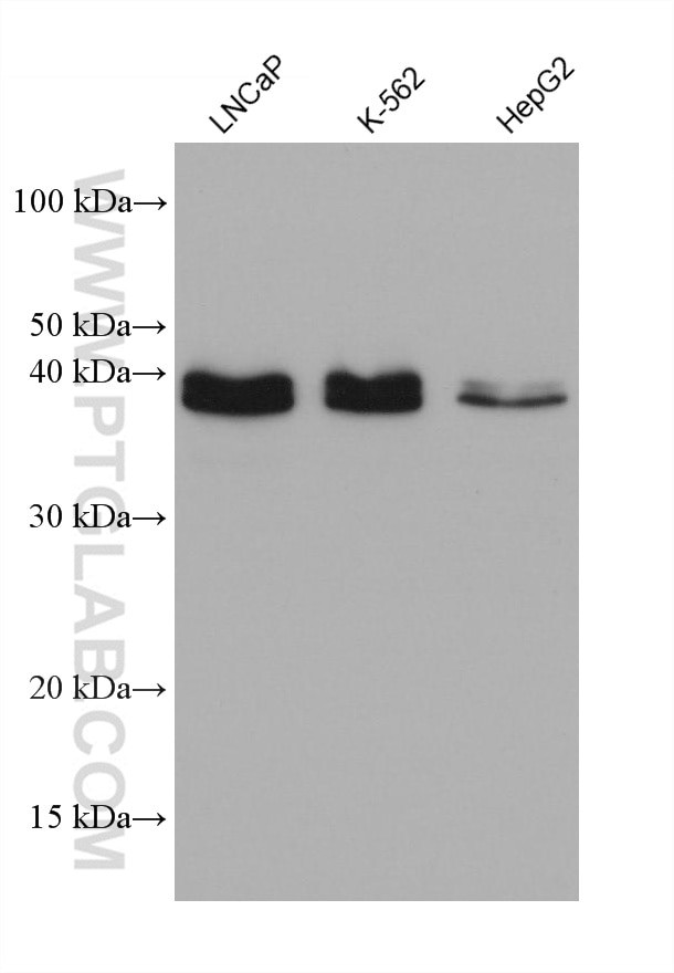 PDCD2L Antibody in Western Blot (WB)