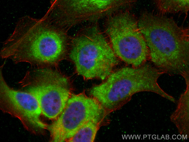 SNX9 Antibody in Immunocytochemistry (ICC/IF)