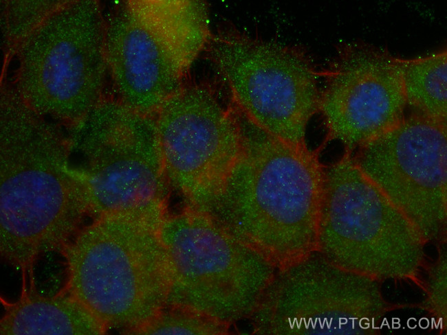 HSPA6 Antibody in Immunocytochemistry (ICC/IF)