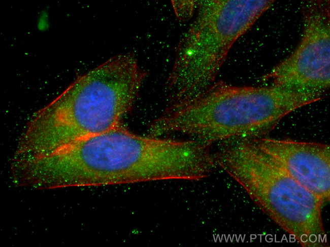 ZER1 Antibody in Immunocytochemistry (ICC/IF)