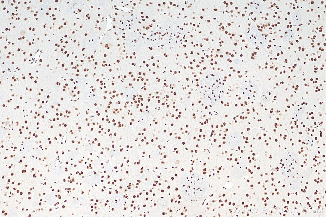 FUS/TLS Antibody in Immunohistochemistry (Paraffin) (IHC (P))