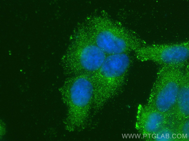 CARD11 Antibody in Immunocytochemistry (ICC/IF)