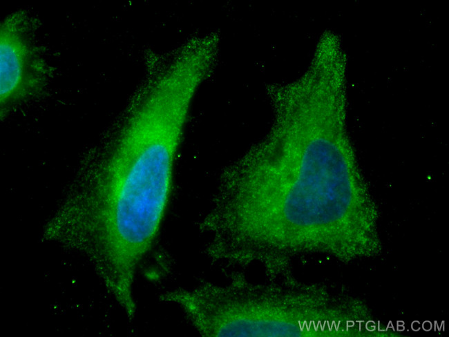 RPS20 Antibody in Immunocytochemistry (ICC/IF)