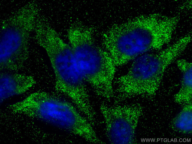BDH2 Antibody in Immunocytochemistry (ICC/IF)