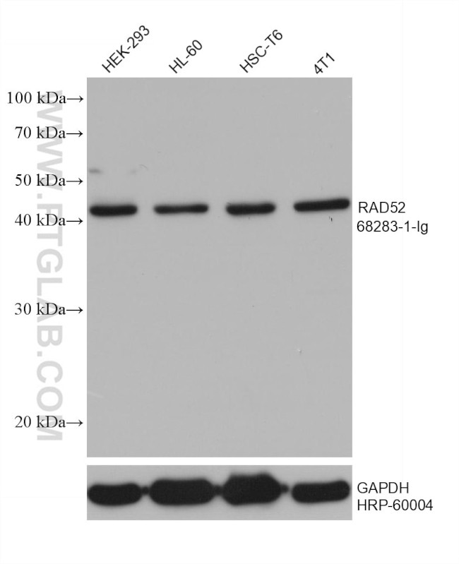 RAD52 Antibody in Western Blot (WB)