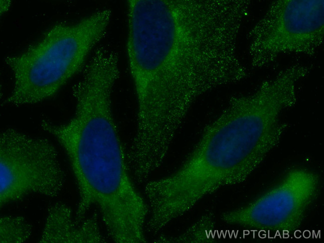 RABEP1 Antibody in Immunocytochemistry (ICC/IF)