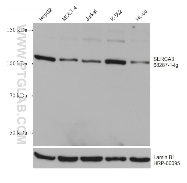 SERCA3 Antibody in Western Blot (WB)