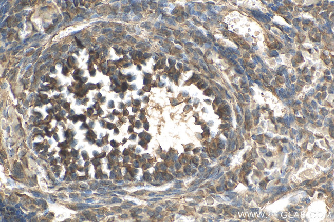 LEPREL2 Antibody in Immunohistochemistry (Paraffin) (IHC (P))