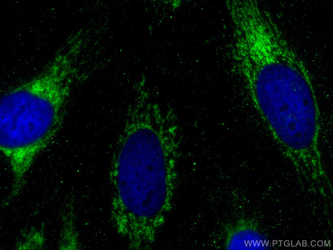 ATP5F1 Antibody in Immunocytochemistry (ICC/IF)