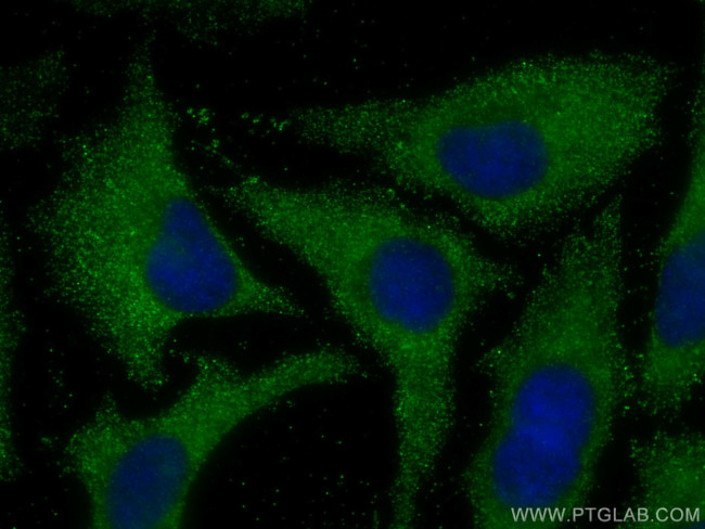 MOCS2 Antibody in Immunocytochemistry (ICC/IF)