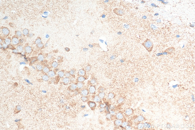 Ataxin 2 Antibody in Immunohistochemistry (Paraffin) (IHC (P))