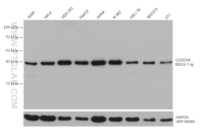 CCDC94 Antibody in Western Blot (WB)