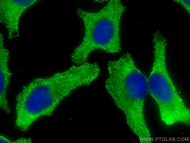 AZI2 Antibody in Immunocytochemistry (ICC/IF)