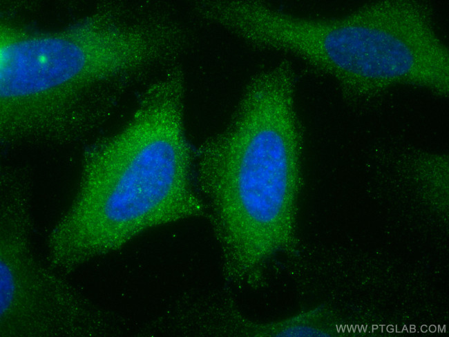 EPS8L2 Antibody in Immunocytochemistry (ICC/IF)