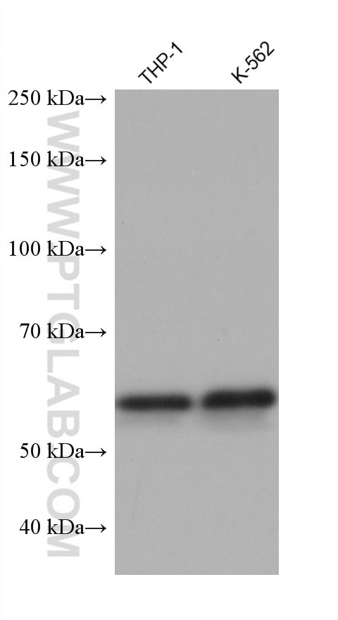 ALAS2 Antibody in Western Blot (WB)
