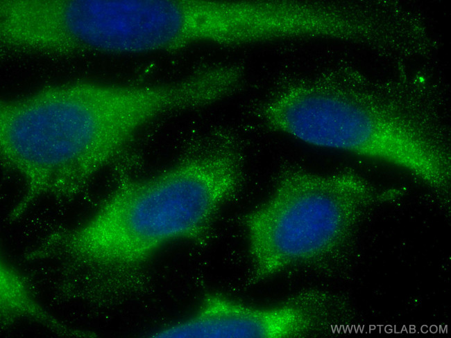 CC2D1A Antibody in Immunocytochemistry (ICC/IF)