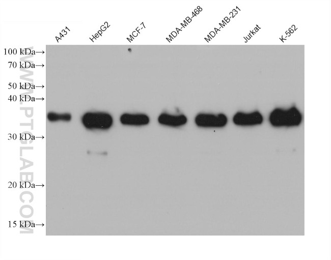 MAD2L1BP Antibody in Western Blot (WB)