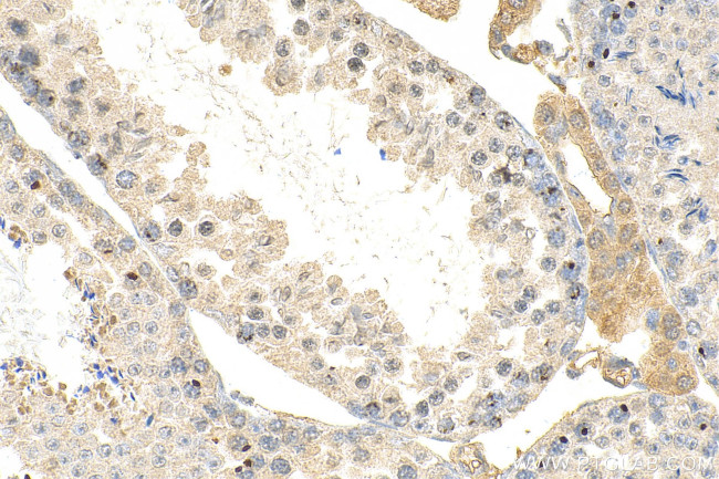THYN1 Antibody in Immunohistochemistry (Paraffin) (IHC (P))