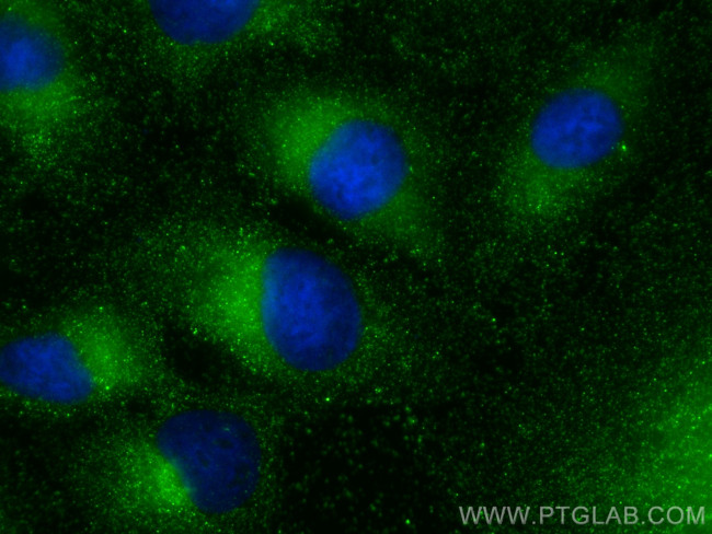 RABL3 Antibody in Immunocytochemistry (ICC/IF)