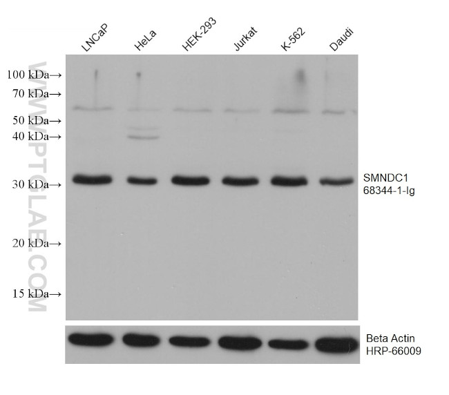 SMNDC1 Antibody in Western Blot (WB)