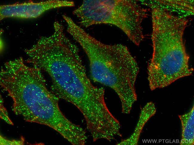 AP2B1 Antibody in Immunocytochemistry (ICC/IF)