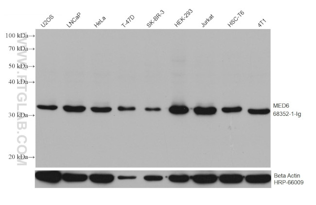 MED6 Antibody in Western Blot (WB)
