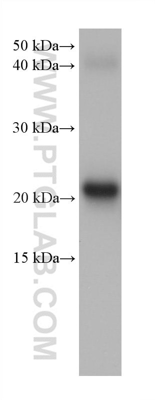 CRYBA2 Antibody in Western Blot (WB)