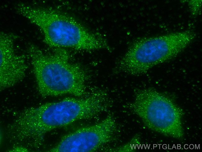 PCYT2 Antibody in Immunocytochemistry (ICC/IF)