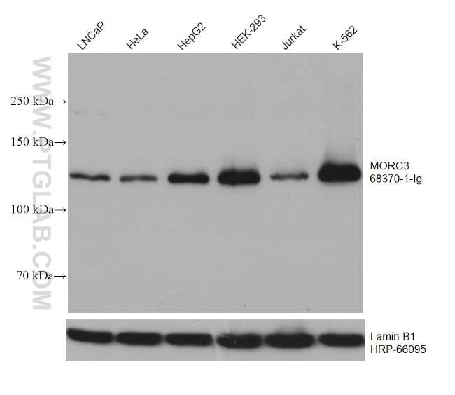 MORC3 Antibody in Western Blot (WB)
