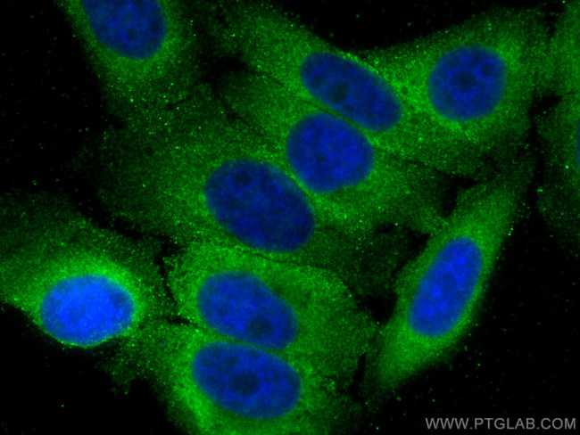 DICER1 Antibody in Immunocytochemistry (ICC/IF)