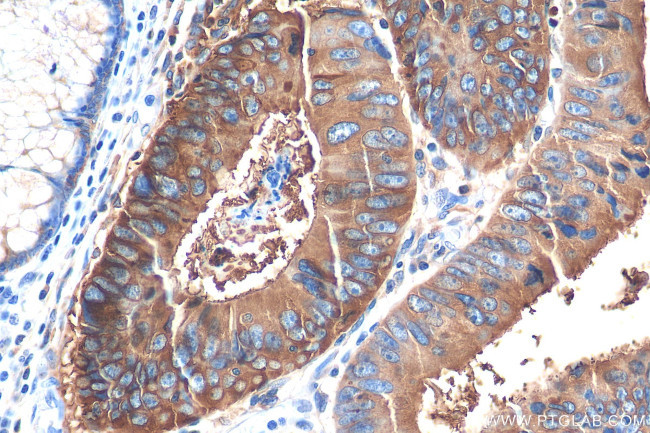CEA Antibody in Immunohistochemistry (Paraffin) (IHC (P))