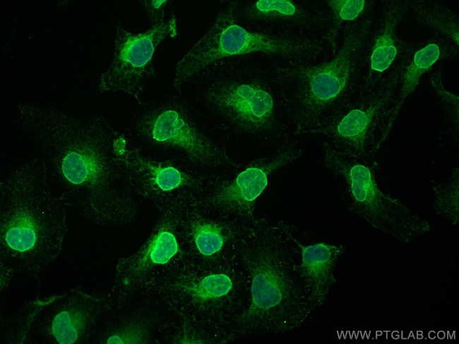 LBR Antibody in Immunocytochemistry (ICC/IF)