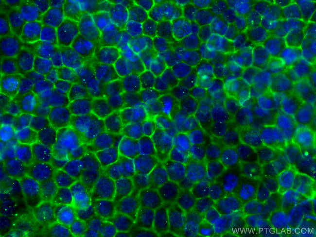 DPP4/CD26 Antibody in Immunocytochemistry (ICC/IF)