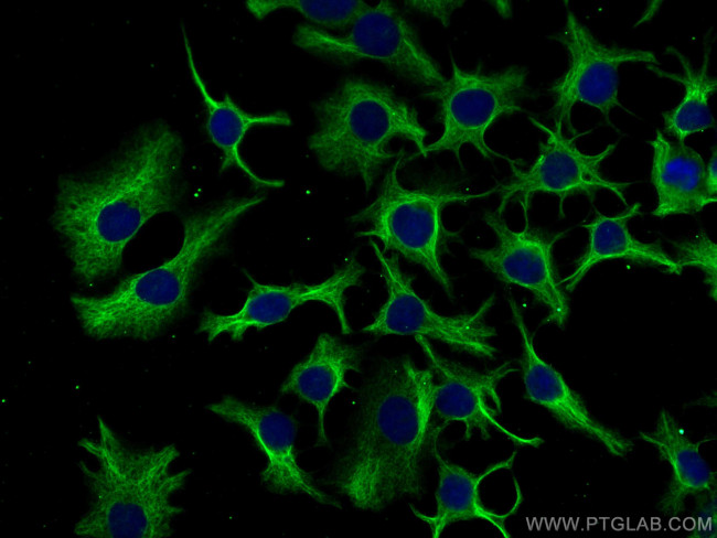 PFKL Antibody in Immunocytochemistry (ICC/IF)