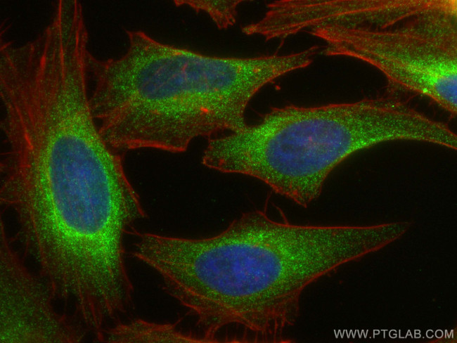 SNX27 Antibody in Immunocytochemistry (ICC/IF)