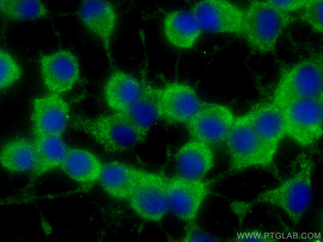 RAB33A Antibody in Immunocytochemistry (ICC/IF)
