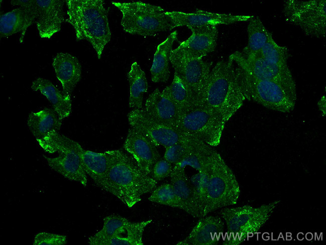 HDDC2 Antibody in Immunocytochemistry (ICC/IF)