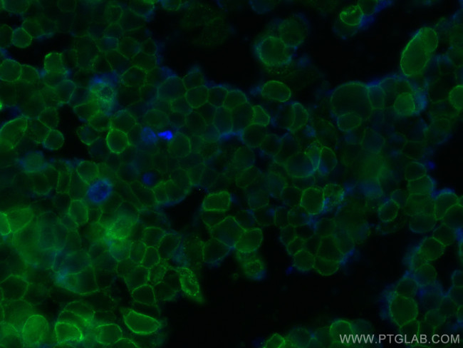 Beta-2-Microglobulin Antibody in Immunocytochemistry (ICC/IF)