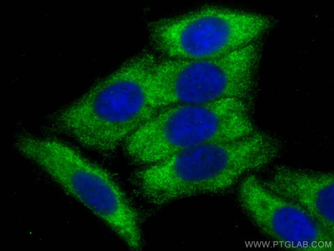 ALDOB Antibody in Immunocytochemistry (ICC/IF)