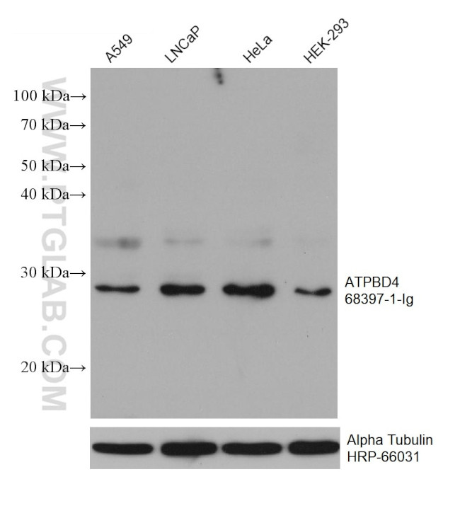 ATPBD4 Antibody in Western Blot (WB)