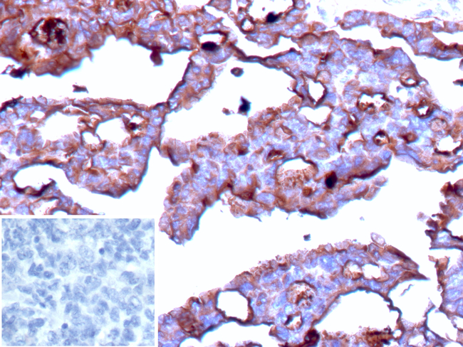 BST2/Tetherin/CD317 (Target for Tumor Immunotherapy) Antibody in Immunohistochemistry (Paraffin) (IHC (P))