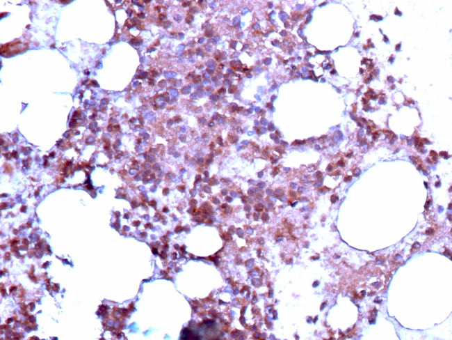 BST2/Tetherin/CD317 (Target for Tumor Immunotherapy) Antibody in Immunohistochemistry (Paraffin) (IHC (P))
