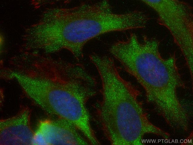 HIP1R Antibody in Immunocytochemistry (ICC/IF)