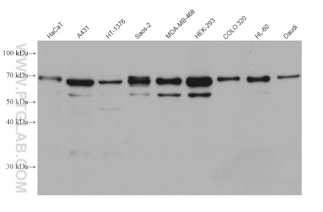 NPHP5/IQCB1 Antibody in Western Blot (WB)