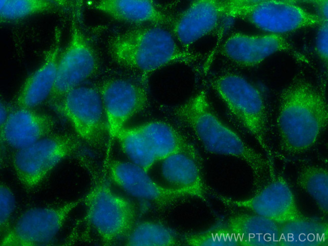 GATC Antibody in Immunocytochemistry (ICC/IF)