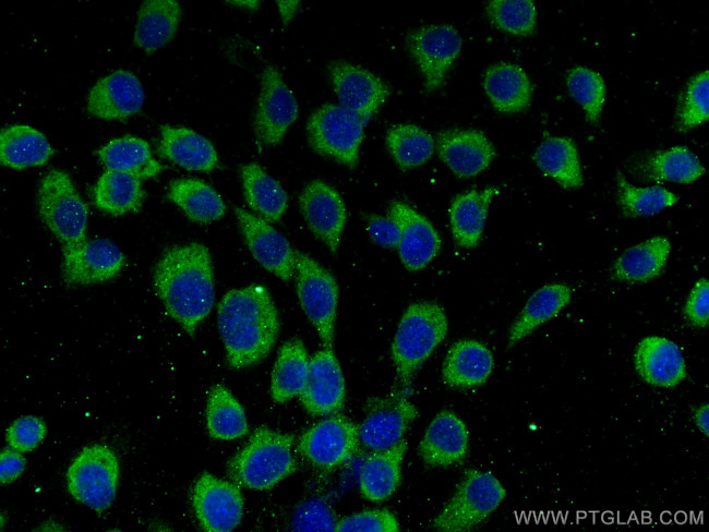 CHMP7 Antibody in Immunocytochemistry (ICC/IF)