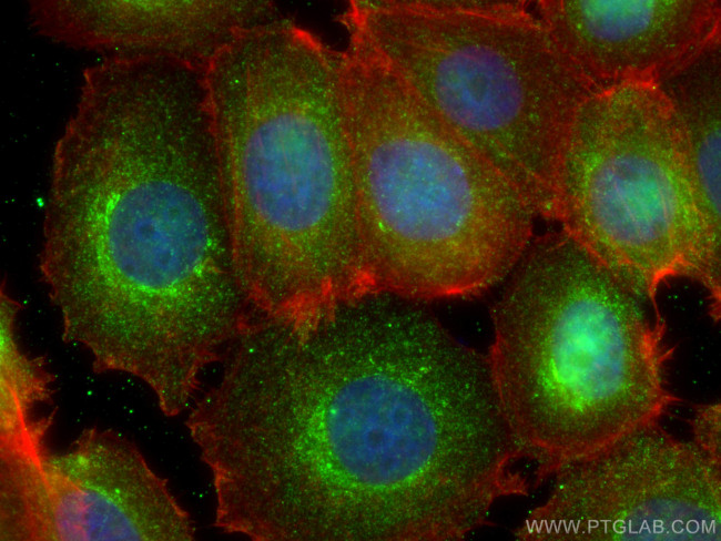STUB1 Antibody in Immunocytochemistry (ICC/IF)
