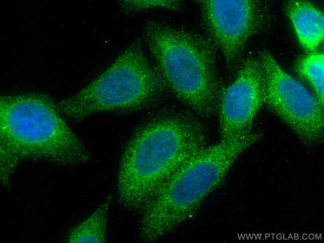 TAP1 Antibody in Immunocytochemistry (ICC/IF)