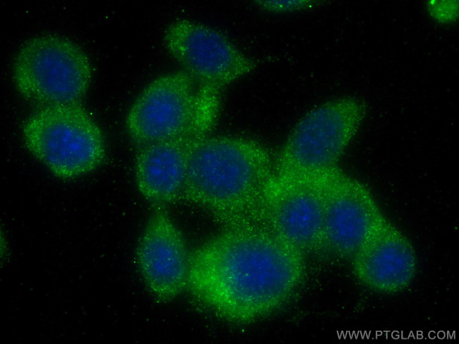 MPI Antibody in Immunocytochemistry (ICC/IF)